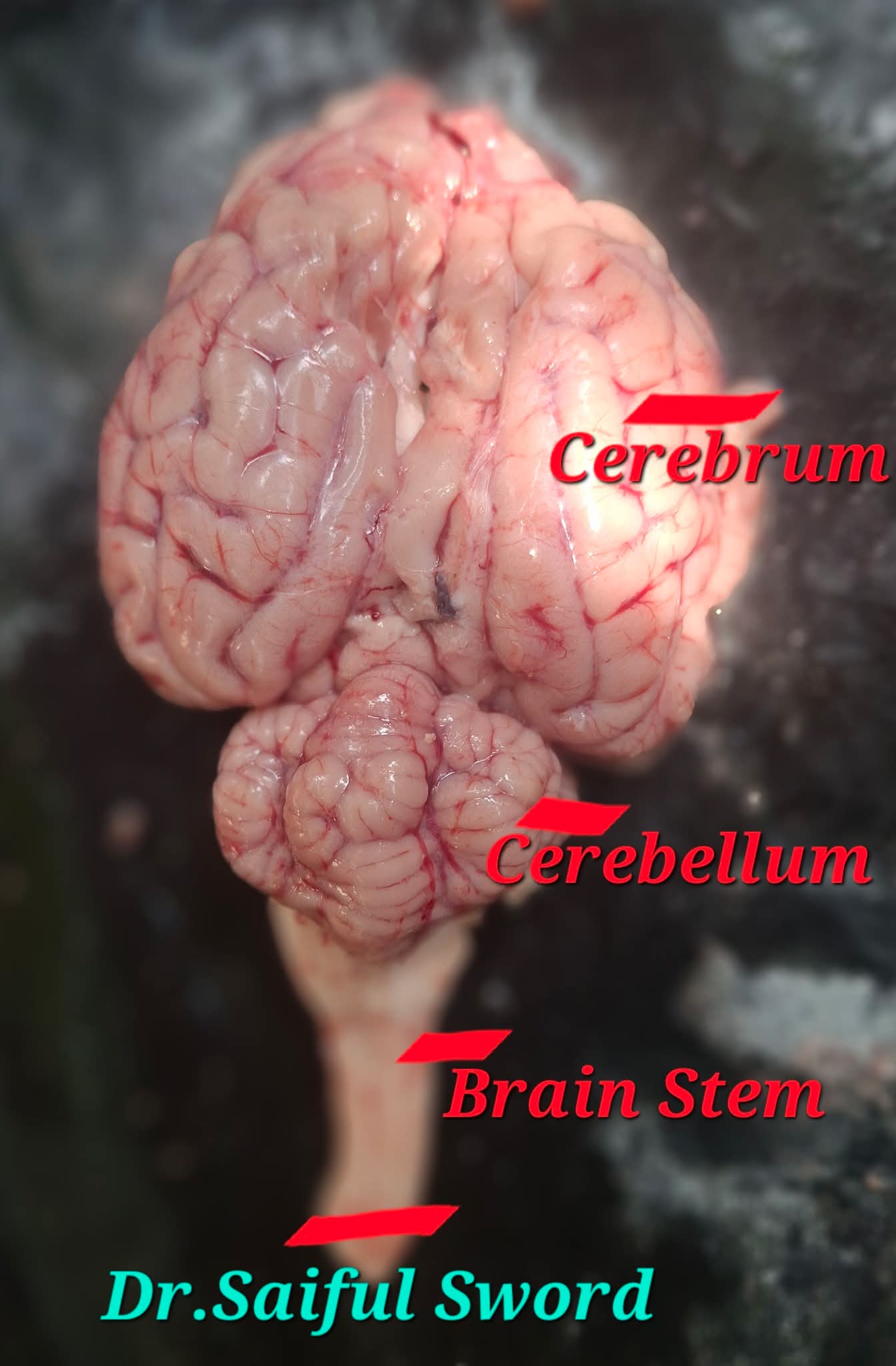 Goat Brain -Anatomy